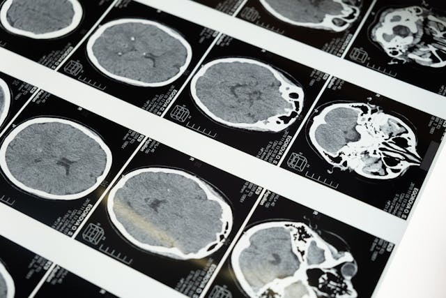 Portable Imaging Devices: The Future of Point-of-Care Diagnostics